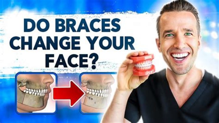 Does your voice change after braces?