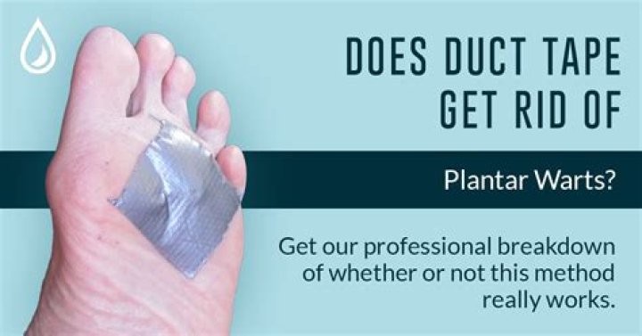 How long does it take to suffocate a wart with duct tape?